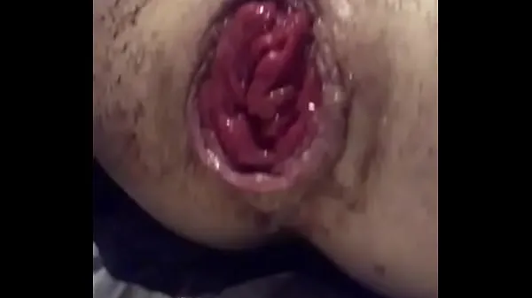 XXX Prolapse energifilmer